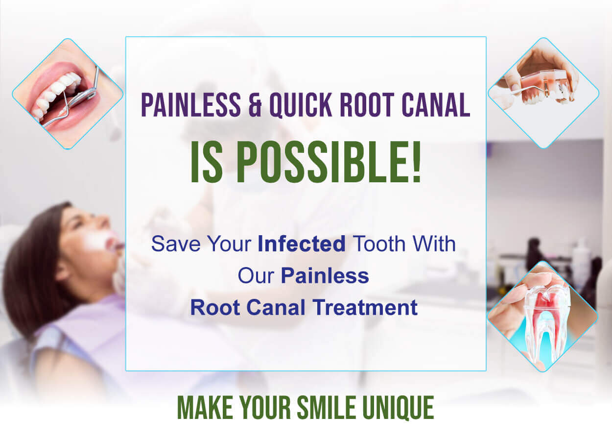 root-canal-blog