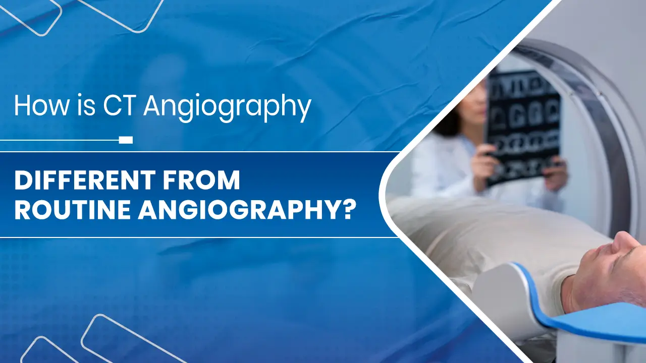 CT Angiography treatment
