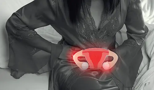 endometriosis surgery in Chandihharh