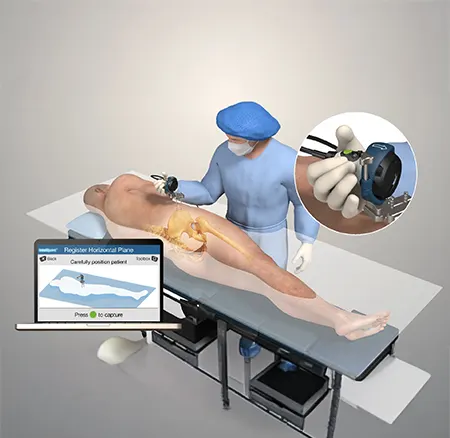 Intellijoint Hip Surgery