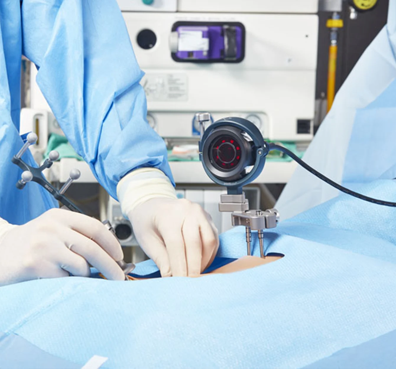 Intellijoint Knee & Hip - AI-powered Technology