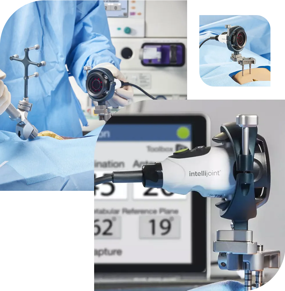 Intellijoint Knee & Hip Surgery