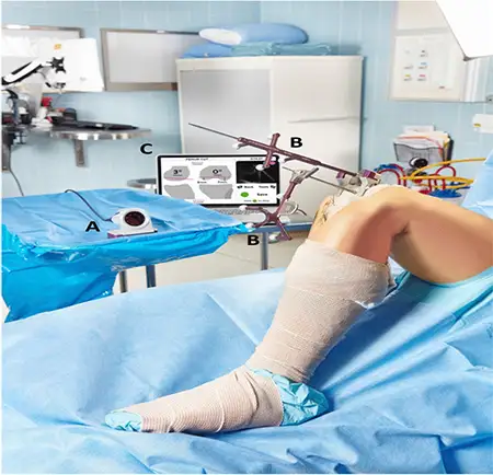 Intellijoint Knee Surgery