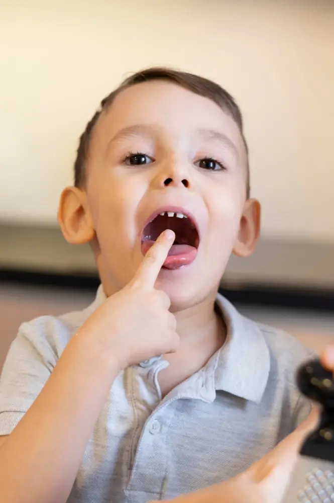 Tongue Tie treatment in mohali